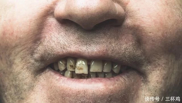请爱护我们的牙齿!